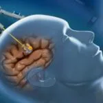This Slime Robot May Transform Surgeries Forever