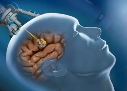 This Slime Robot May Transform Surgeries Forever